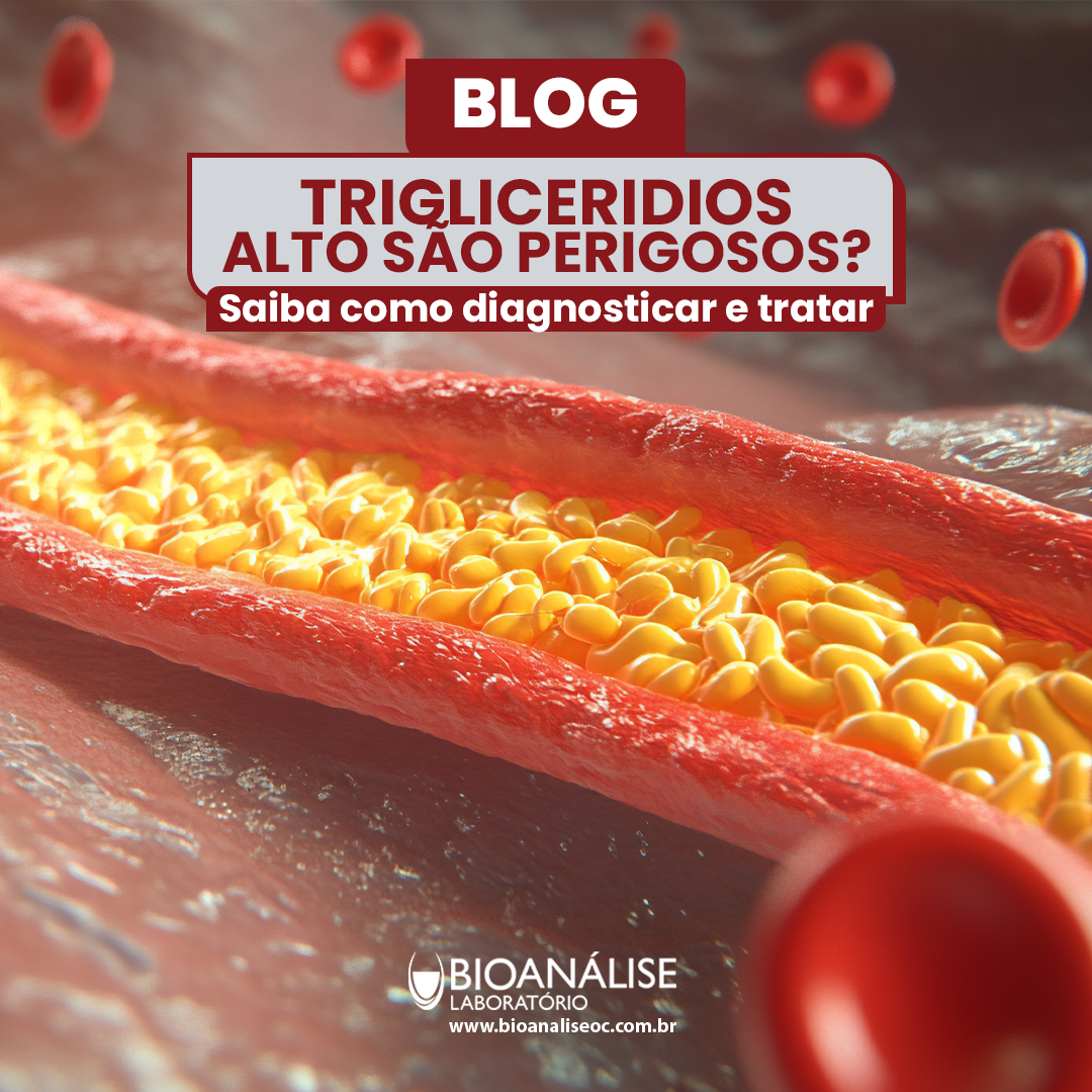 Triglicerídeos altos são perigosos? Saiba diagnosticar e tratar
