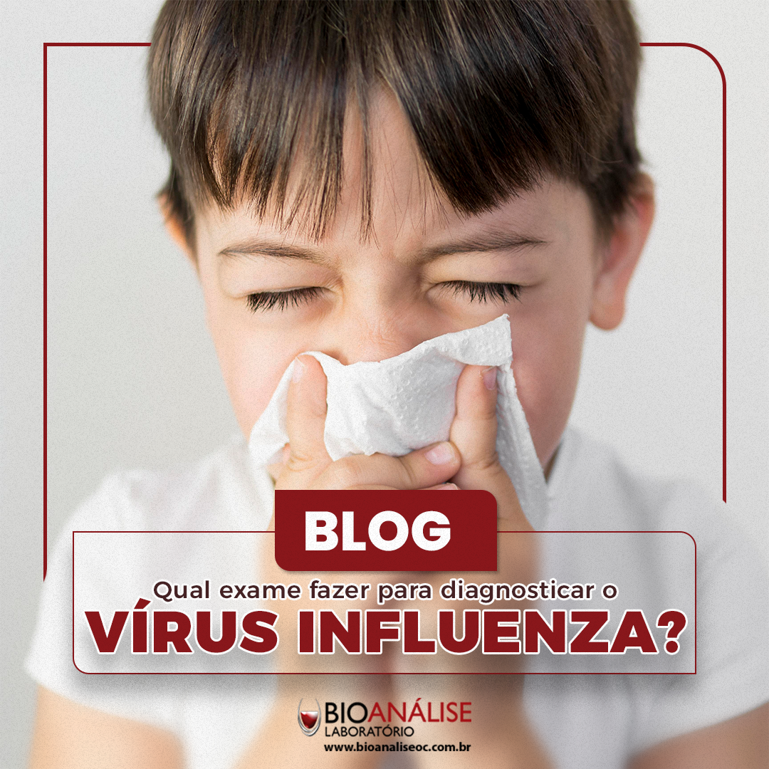 Qual exame fazer para diagnosticar o vírus Influenza?