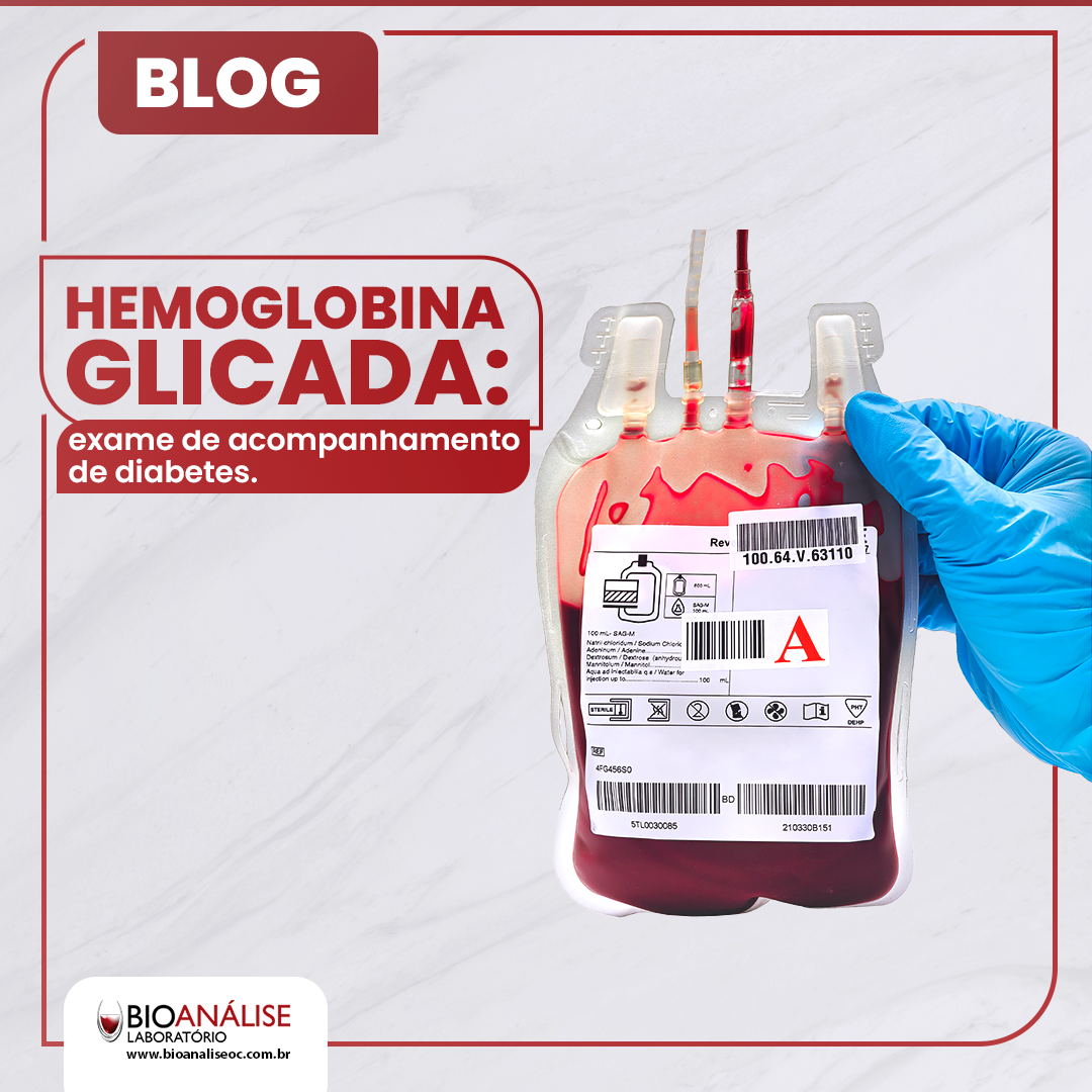 Hemoglobina Glicada: exame fundamental para o acompanhamento diabético