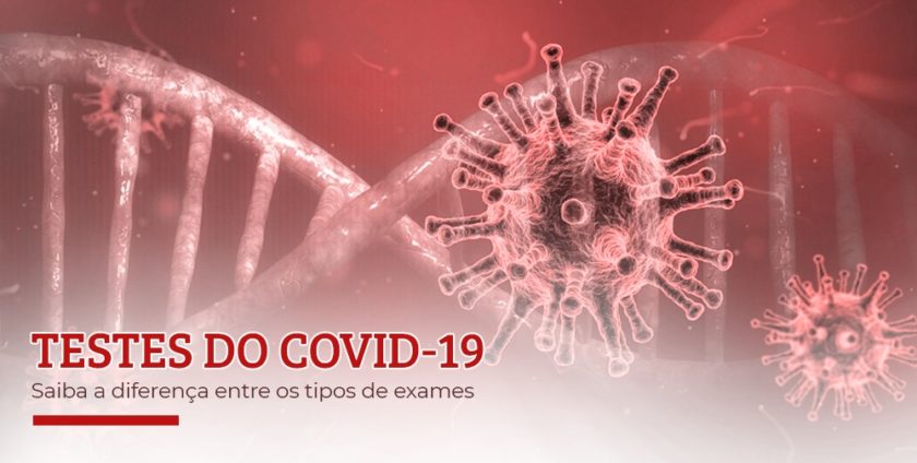 Conheça os diferentes tipos de testes para covid-19